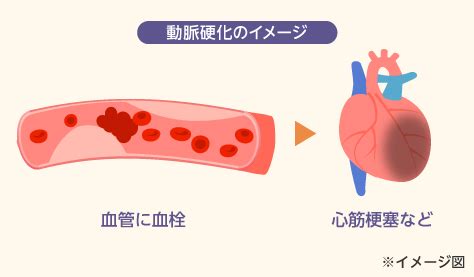 血管青色|血管のはなし｜血液・血管の総合サイト ..